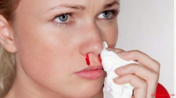 Bà bầu bị chảy máu cam có phải dấu hiệu bất thường hay không? 1