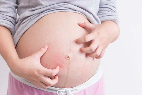 Bà bầu bị ngứa chớ chủ quan mà bỏ qua 1