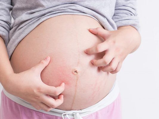 Bà bầu bị ngứa chớ chủ quan mà bỏ qua