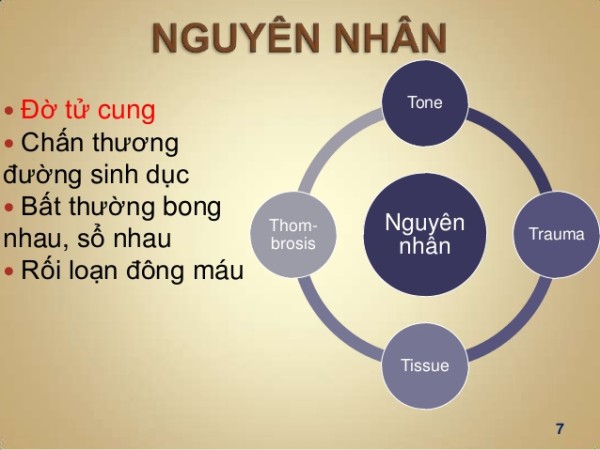 Nguyên nhân gây băng huyết sau sinh 1